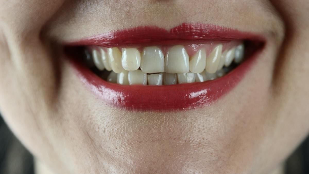 Эти привычки испортят вам зубы: что не стоит делать - Здорово